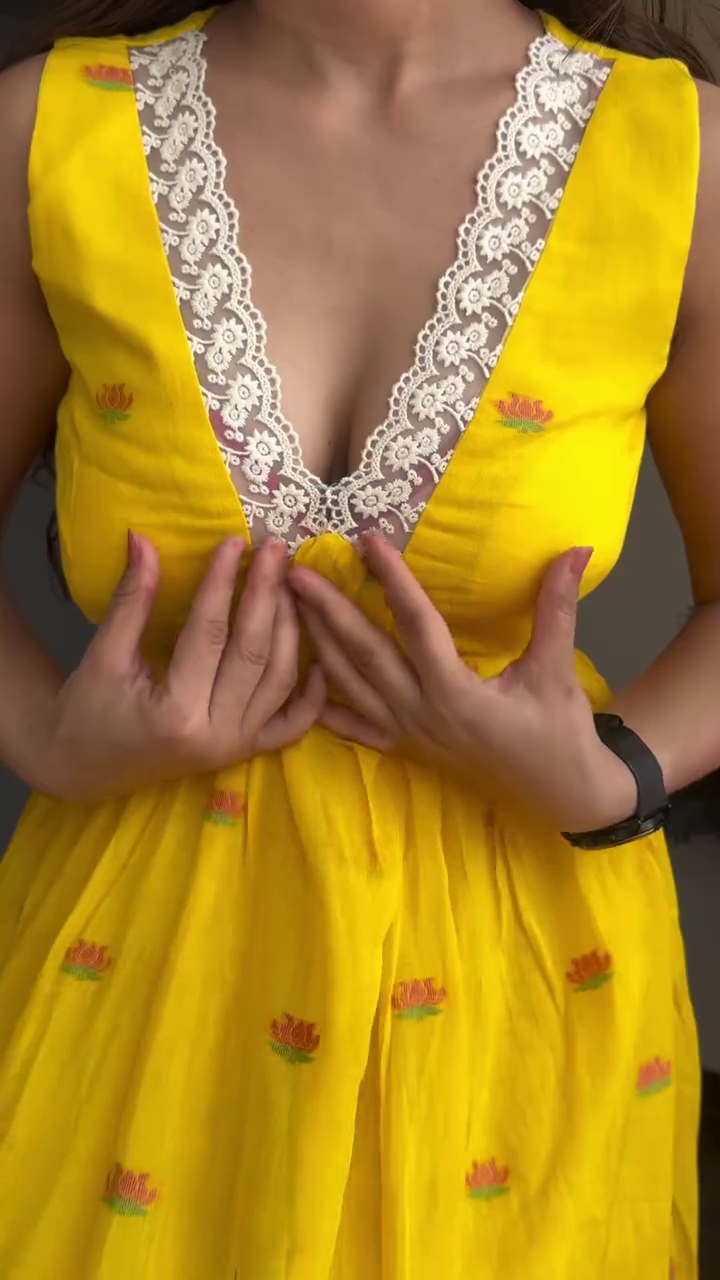 “Sunshine Bloom Midi Dress 🌼💛 | Lace Trim Flowy Summer Dress”